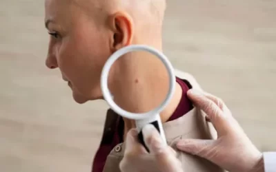 Annual Skin Cancer Checkups